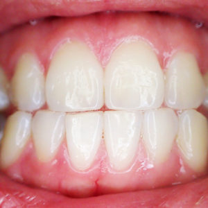 Close up of perfect teeth